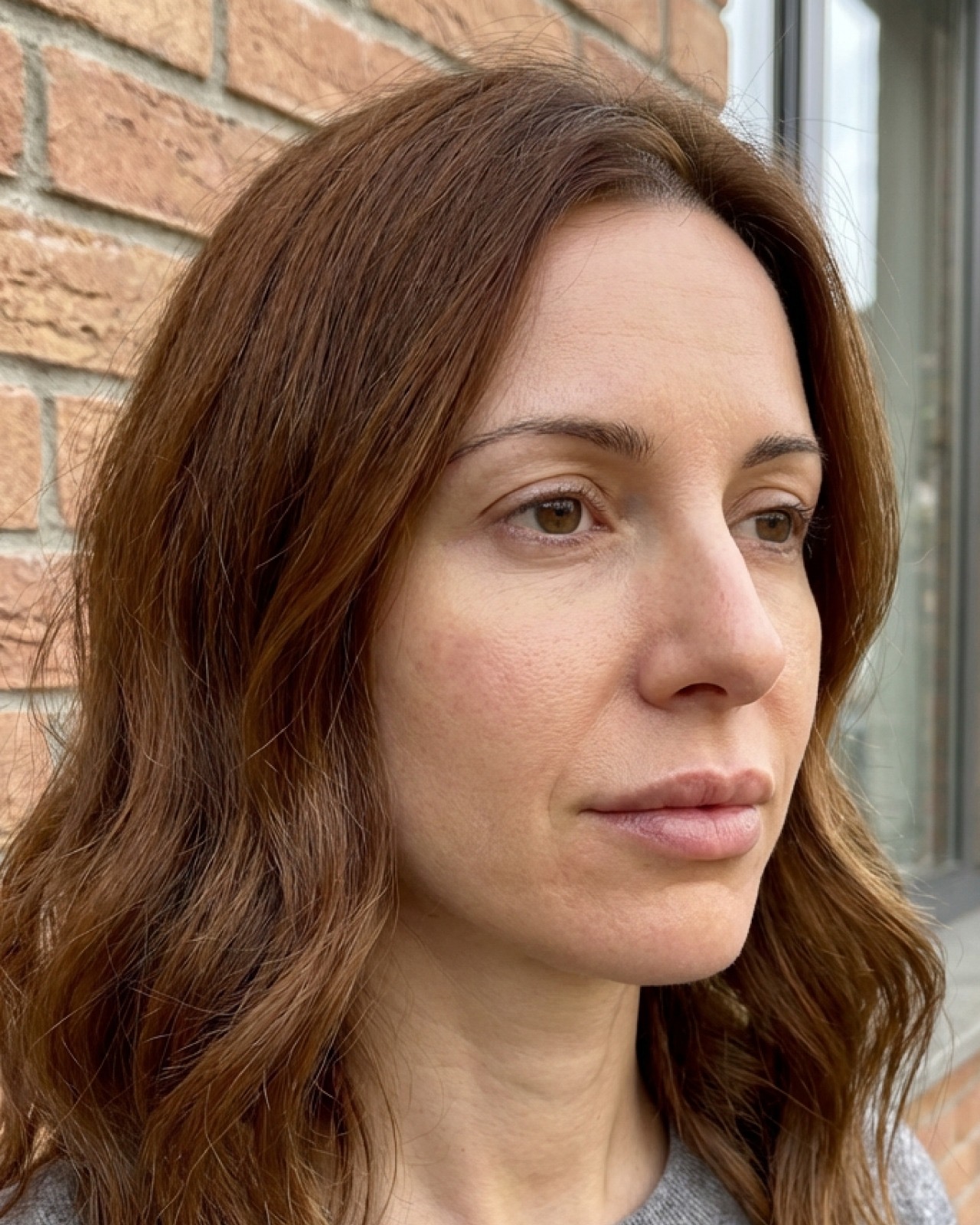 prima e dopo botox labbra milano dopo quanto tempo avete rifatto il botox alle labbra? vale la pena ripeterlo regolarmente o solo ogni tanto per mantenere l’effetto? foto dopo 1 mese - 695