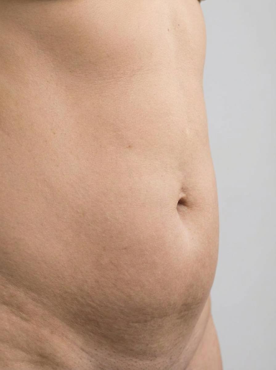 prima e dopo cavitazione cavitazione medica addome casale monferrato cavitazione medica per migliorare addome foto dopo - 453