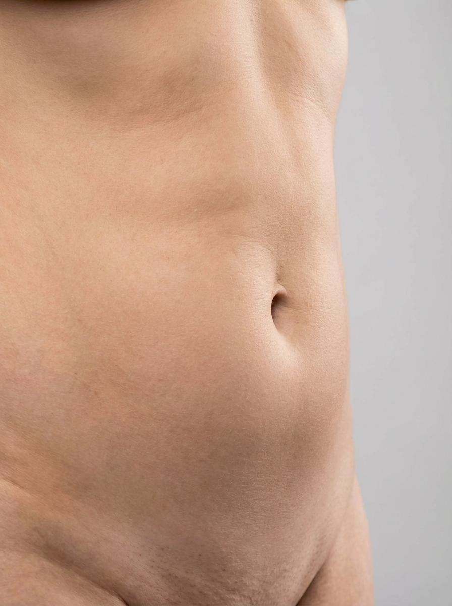 prima e dopo cavitazione cavitazione ultrasonica addome nizza monferrato cavitazione ultrasonica per migliorare addome foto dopo - 450