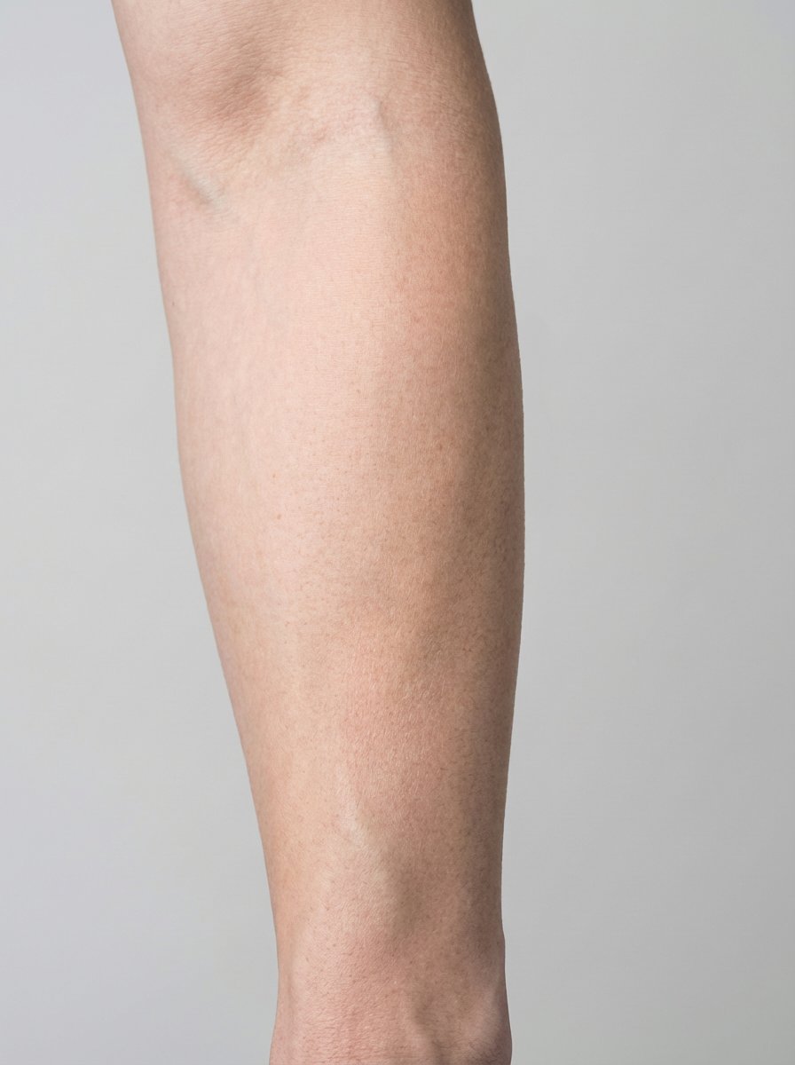 prima e dopo depilazione laser depilazione laser braccia braccia egna depilazione laser braccia per migliorare braccia foto dopo - 653