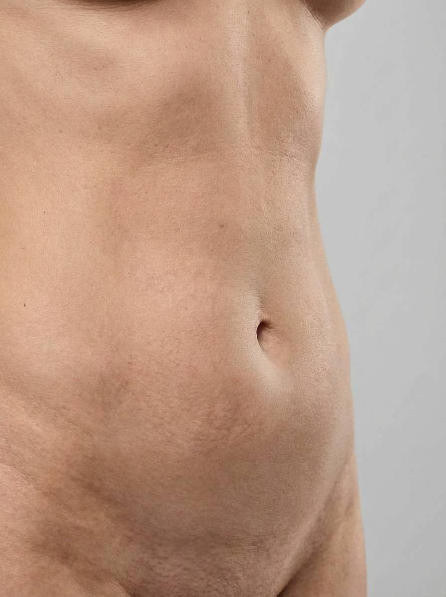 prima e dopo emsculpt emsella addome avola emsella per migliorare addome foto dopo - 511