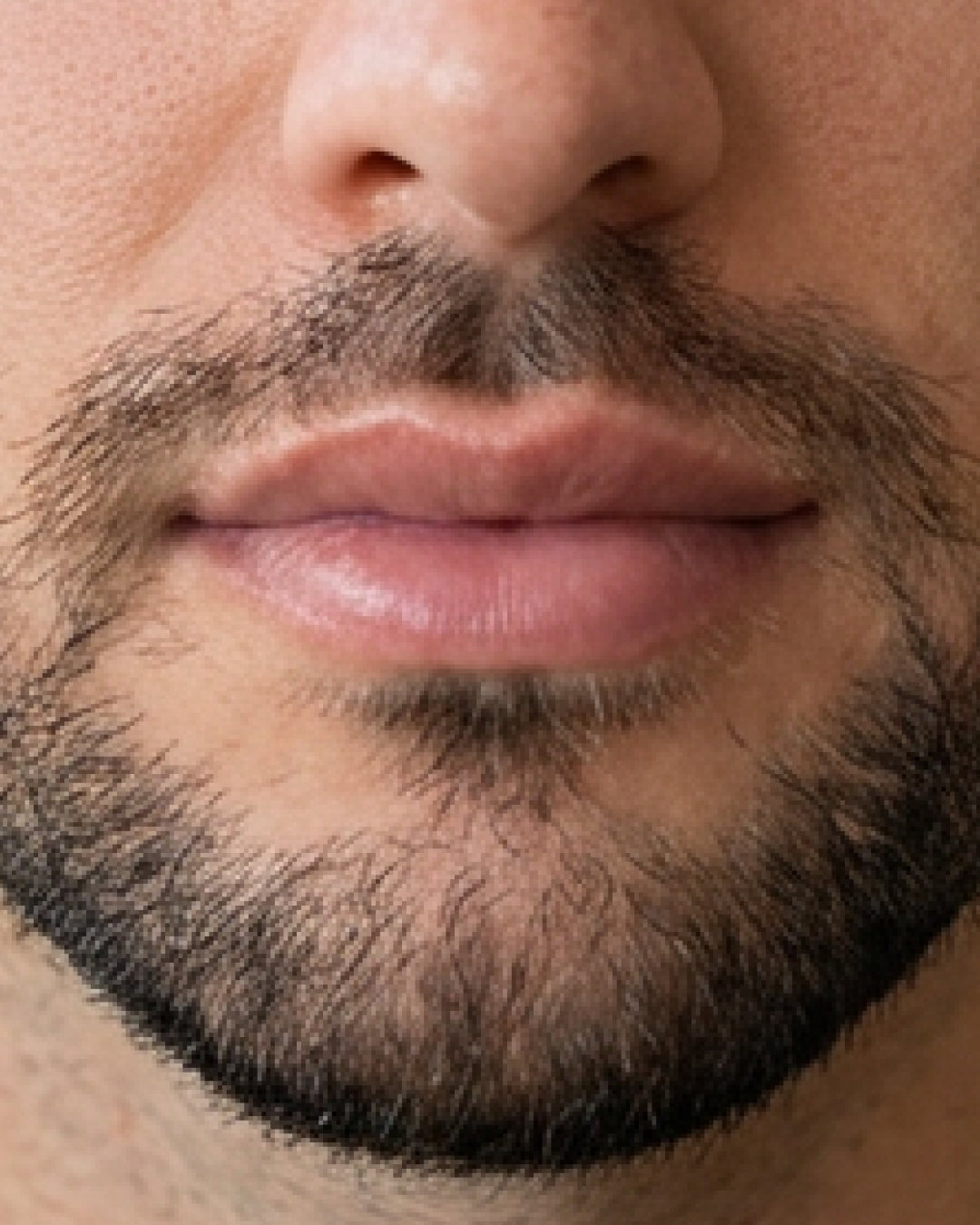 prima e dopo filler labbra uomo trento filler a trento 31-40 anni foto dopo 6 mesi - 697