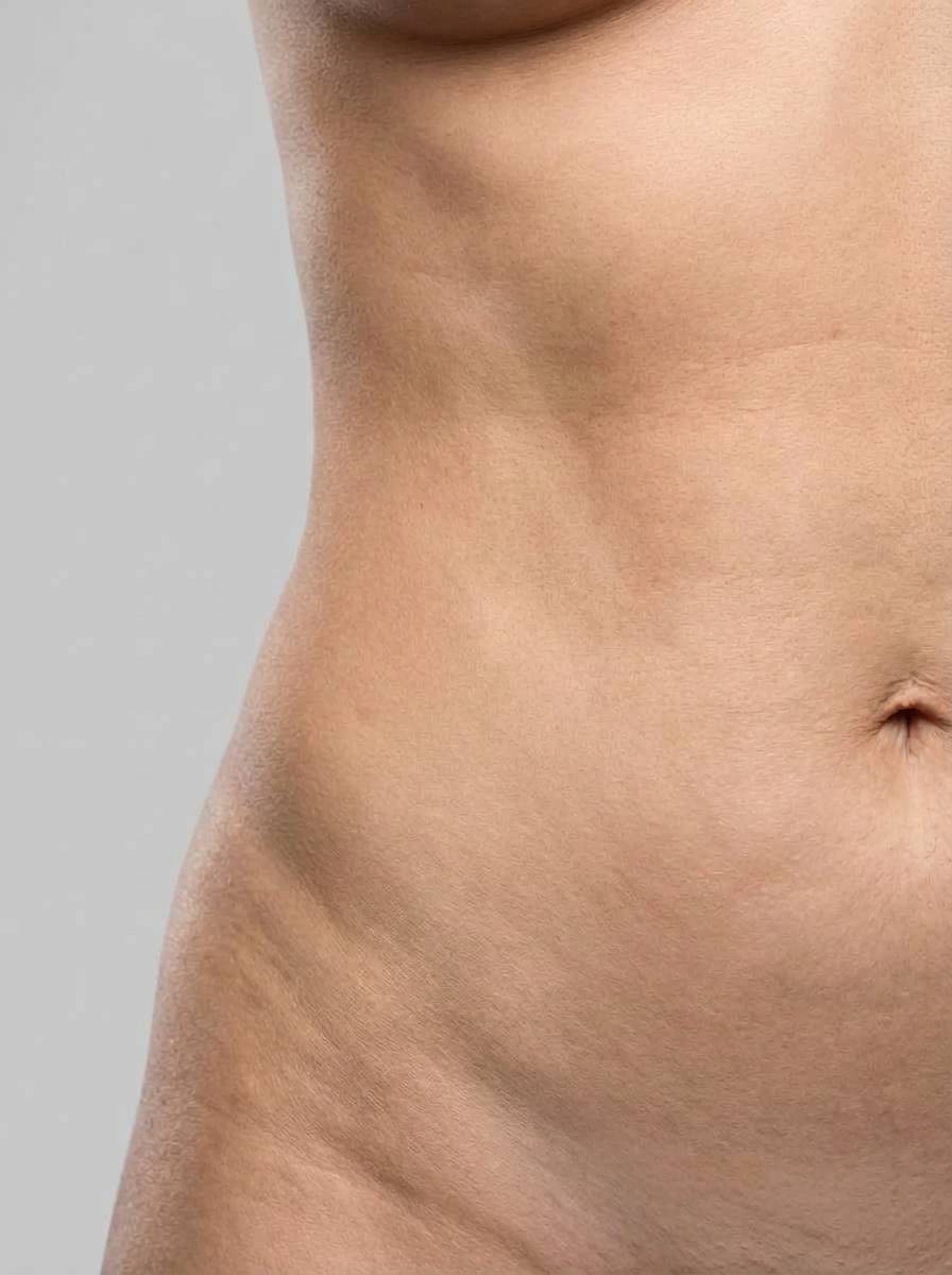 prima e dopo laser laserlipolisi smartlipo corpo termini imerese laserlipolisi smartlipo per migliorare corpo foto dopo - 525