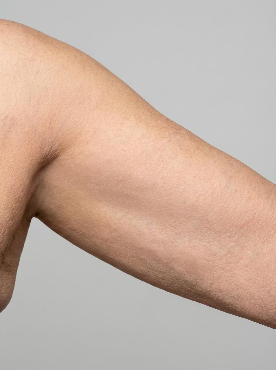 prima e dopo lifting lifting mini braccia rosignano marittimo lifting mini per migliorare braccia foto dopo - 236