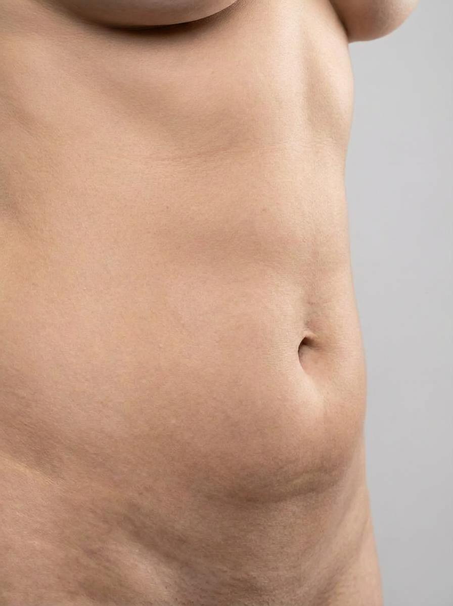 prima e dopo liposuzione liposuzione vaser addome mirano liposuzione vaser per migliorare addome foto dopo - 345