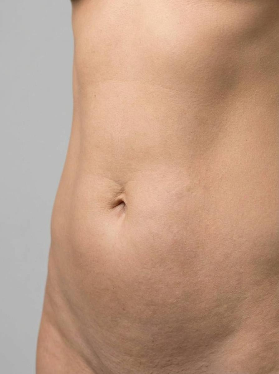 prima e dopo liposuzione liposuzione 3d addome sedico liposuzione 3d per migliorare addome foto dopo - 367