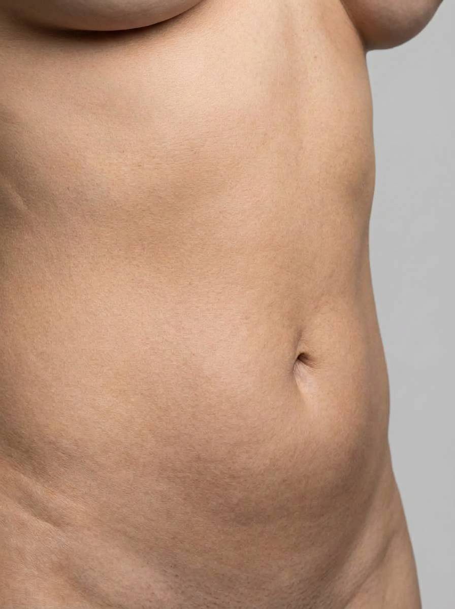 prima e dopo liposuzione addome vibo valentia liposuzione per migliorare addome foto dopo - 321