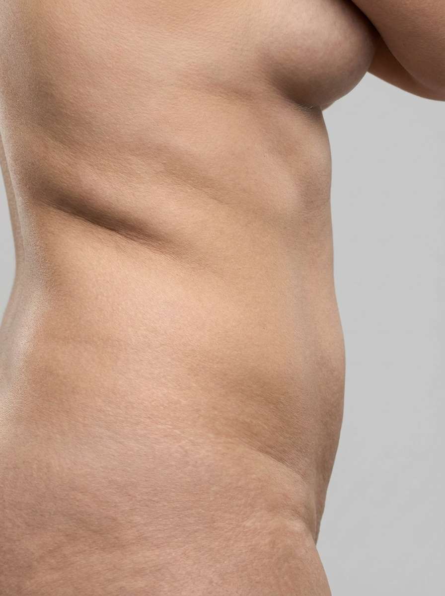 prima e dopo liposuzione liposuzione laser fianchi lavello liposuzione laser per migliorare fianchi foto dopo - 335