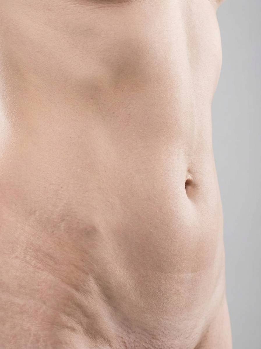 prima e dopo mommy makeover corpo cuorgnè mommy makeover per migliorare corpo foto dopo - 558