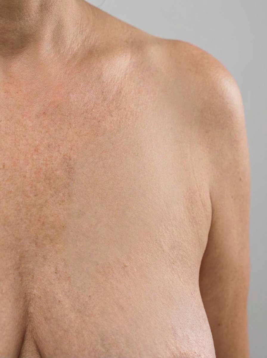 prima e dopo tatuaggio seno alatri tatuaggio per migliorare seno foto dopo - 288