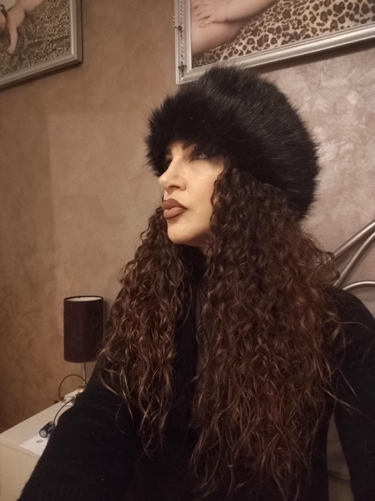 prima e dopo rinoplastica rinoplastica estetica naso roma rinoplastica a roma foto 6 mesi - 706