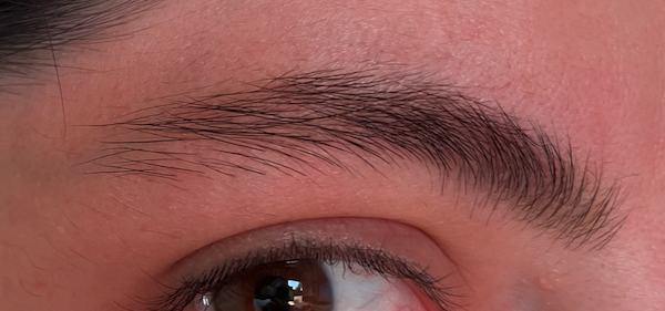 prima e dopo tatuaggio rimozione tatuaggio sopracciglia milano tatuaggio a milano foto 1 anno - 709